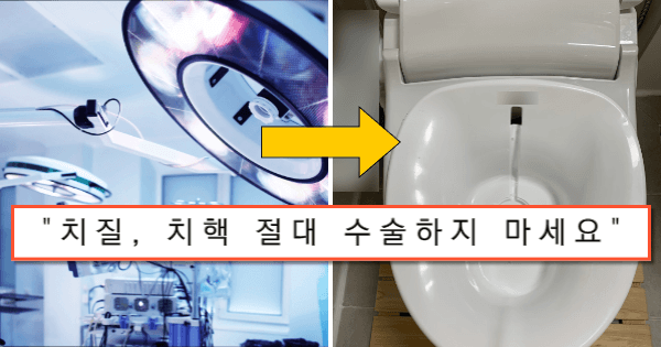 치질, 치핵 절대로 수술하지 마세요 | 정보 보물창고